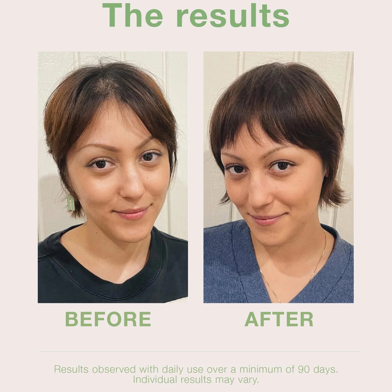 Mumms | Scalp Serum